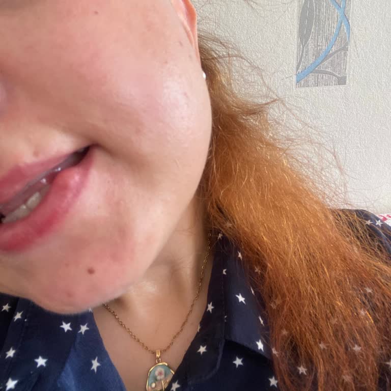 Blue Diamond Güzellik Merkezi Dudak Dolgusu Mağduriyeti