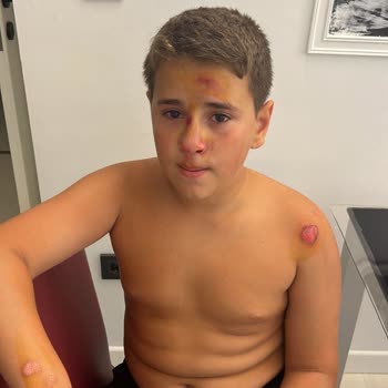 RKS Elektrikli Bisiklette Emniyet Pimi Arızası Nedeniyle Yaşanan Güvenlik Sorunu Ve Mağduriyet