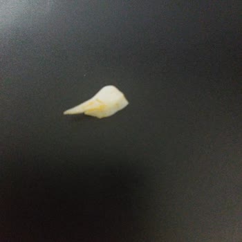 Islak Burgerin İçinden Çıkan Büyük Plastik Parçası Endişe Yarattı