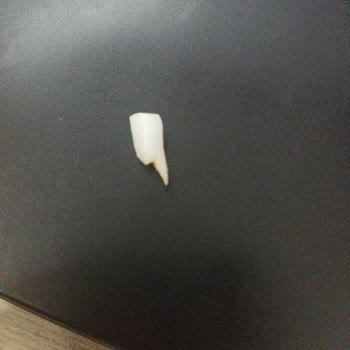 Islak Burgerin İçinden Çıkan Büyük Plastik Parçası Endişe Yarattı