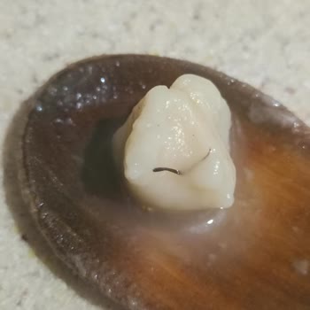 Hazır Mantıdan Çıkan Yabancı Madde Nedeniyle Hayal Kırıklığı