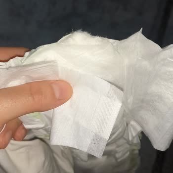 Bebek Bezinde Yırtık Ve Sökükle Karşılaştım Mağdur Oldum