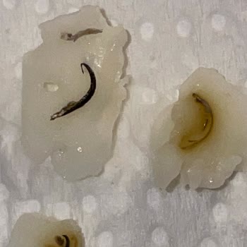 Ünal Peynircilik Beyaz Peynir İçinden Metal Parça Çıkması Şaşkınlığı Ve Endişesi