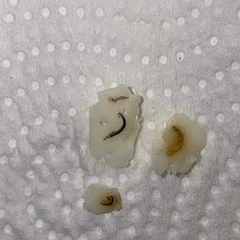 Ünal Peynircilik Beyaz Peynir İçinden Metal Parça Çıkması Şaşkınlığı Ve Endişesi