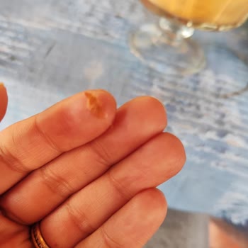 Dondurmadan Kıl Yumağı Çıktı, Sağlığımız Tehlikede!