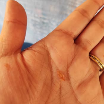 Dondurmadan Kıl Yumağı Çıktı, Sağlığımız Tehlikede!