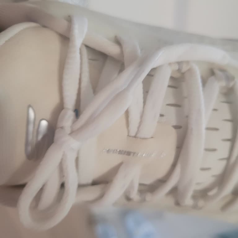 Topuk Dikeni İçin Aldığım Ayakkabı Kısa Sürede Sarardı