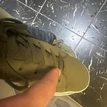 Adidas Yeni Ayakkabıda Dikiş Hatası ve Deformasyon Şikayeti