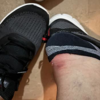 Skechers Ayakkabı Topuk Yarası Ve İlgisiz Müşteri Hizmeti Mağduriyeti