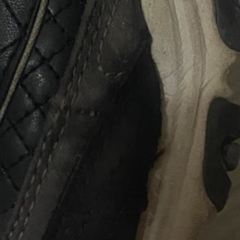 I Got Skechers D'Lites and the Toe Split in Weeks