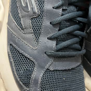 I Bought Skechers Dynamight 2.0 and Its Sides Tore Despite Minimal Use