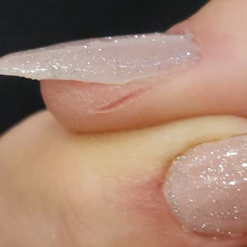 Bakırköy Şubesinde Hijyen Eksikliği Ve İlgisiz Tavırlar Parmaklarımda Ciddi Yaralar Oluştu