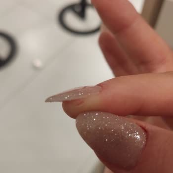 Bakırköy Şubesinde Hijyen Eksikliği Ve İlgisiz Tavırlar Parmaklarımda Ciddi Yaralar Oluştu