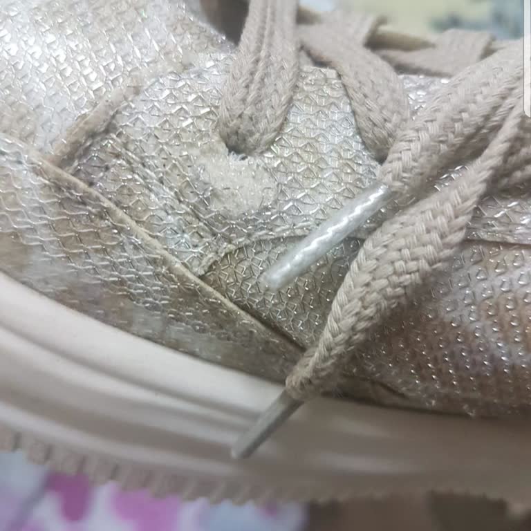 Marjin Marka Sneakerın Soyulan Yüzeyi Ve İade Reddi Mağduriyeti