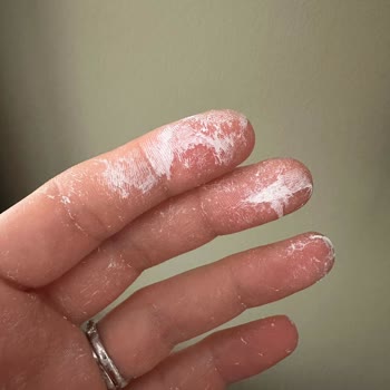 Mundo Puro Trendyol'dan Satın Alınan Güneş Kreminde Sahte Ürün Şüphesi Ve Mağduriyet