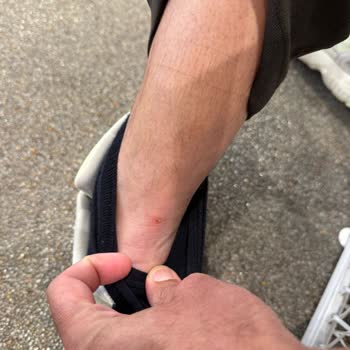 İlk Kullanımda Ciddi Yaralara Sebep Olan Ayakkabı İçin İade Talebim Reddedildi