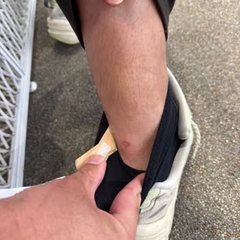 İlk Kullanımda Ciddi Yaralara Sebep Olan Ayakkabı İçin İade Talebim Reddedildi