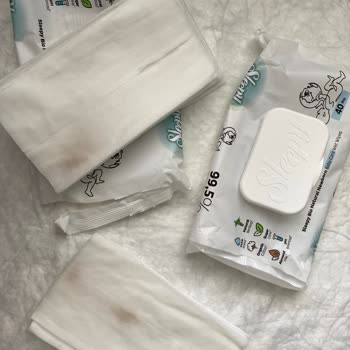 Küflü Mendiller Nedeniyle Mağduriyet Ve Sağlık Endişesi