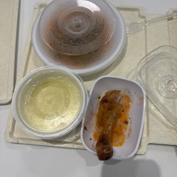 Etlik Şehir Hastanesi Yemeklerinde Soğuk Ve Kalitesiz Hizmet