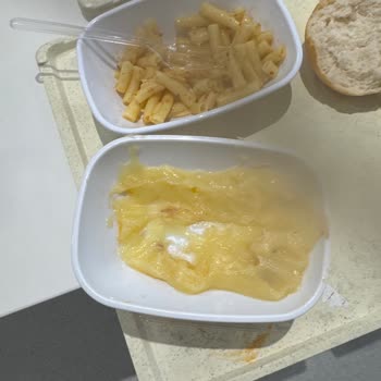 Etlik Şehir Hastanesi Yemeklerinde Soğuk Ve Kalitesiz Hizmet