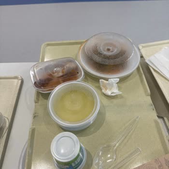 Etlik Şehir Hastanesi Yemeklerinde Soğuk Ve Kalitesiz Hizmet