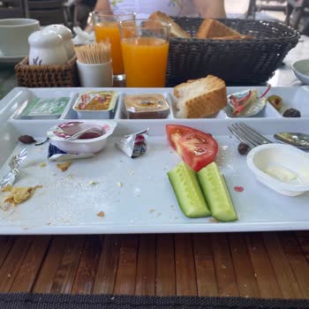 Anadol Hotel Girne Kötü Temizlik Ve Yetersiz Hizmet Deneyimi!