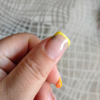 Nail Art Sonrası Tırnaklarda Yeşerme Ve Kötü İşçilik Deneyimi
