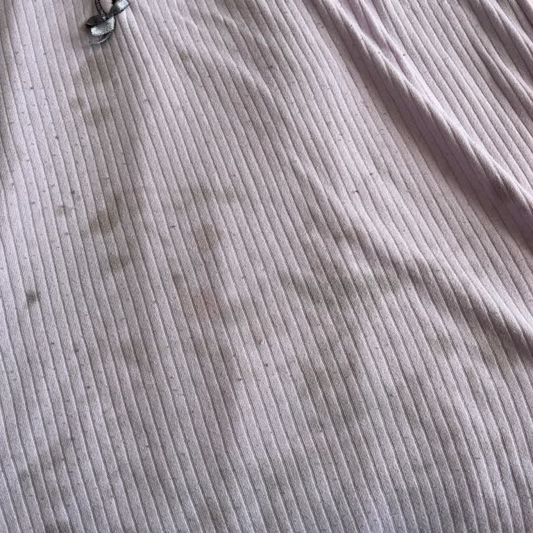 Arçelik Çamaşır Makinesi Gri Leke Sorunu Ve Servis İlgisizliği