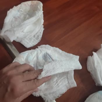 Molfix Külot Bezlerinde Sürekli Yırtık Ve Açık Kenar Sorunu, Geri Dönüş Alınamıyor