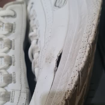 Skechers Ayakkabım 5 Ayda Deforme Oldu, Mağduriyetimin Giderilmesini İstiyorum