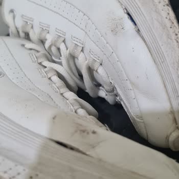 Skechers Ayakkabım 5 Ayda Deforme Oldu, Mağduriyetimin Giderilmesini İstiyorum
