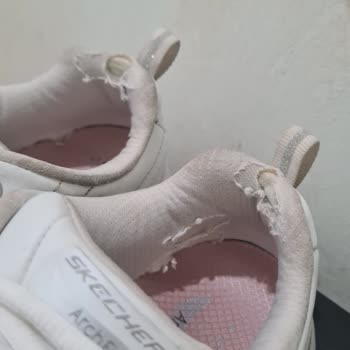 Skechers Ayakkabım 5 Ayda Deforme Oldu, Mağduriyetimin Giderilmesini İstiyorum
