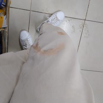 Açıkta Bırakılan Çamaşır Suyu Nedeniyle Kıyafetim Zarar Gördü, Personel İlgisizdi