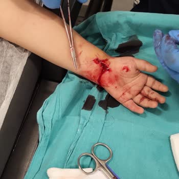 Parktaki Cam Parçası Yüzünden Çocuğum Yaralandı