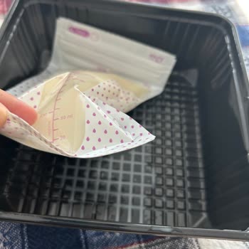 Mochi Süt Pompası Ve Saklama Torbası Mağduriyeti Erken Doğum Sonrası Yaşanan Sorunlar