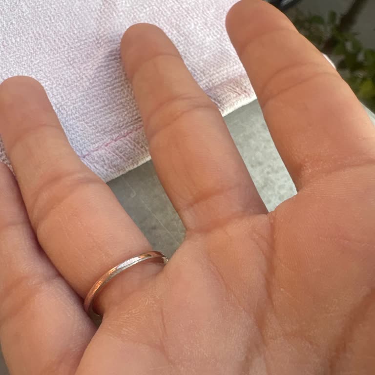 Pandora Yüzükte Renk Atması Ve Müşteri Hizmetleri Sorunu