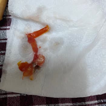 Burger King Adana Dörtyol Şubesinde Eksik Ve Hatalı Menü Deneyimi