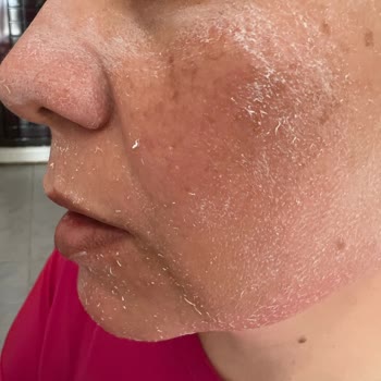 Aldığım Bioderma Krem Sahte Çıktı İade Talebim Reddedildi