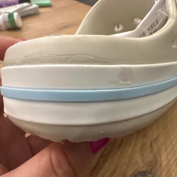 Stepza Aldığım Ürün Yıpranmış ve Kutusuz Gönderildi İade Süreci De Sorunlu