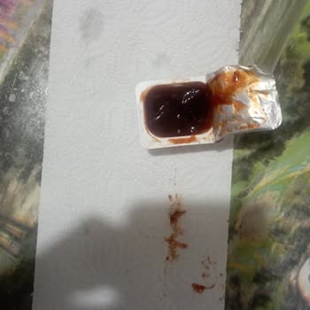 Barbekü Sosun İçinden Çıkan Ayak Tırnağıyla Büyük Hijyen Sorunu Yaşadım