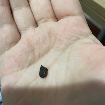 Kahve Dünyası Çikolatanın İçinden Taş Gibi Sert Yabancı Madde Çıktı Dişlerim Zonkladı