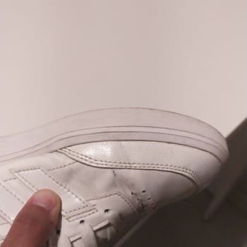 Adidas Ürünü Kısa Sürede Açıldı Garanti Kullanıcı Hatası Dedi
