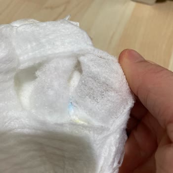 Bebek Bezinde Kristal Benzeri Madde Ve Pişik Sorunu