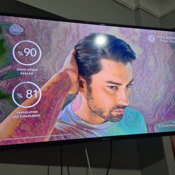 Onvo Televizyonun Garanti Sonrası Devam Eden Ekran Arızası Ve Değişim Talebi