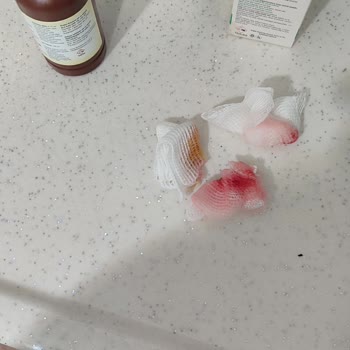 Bebek Mama Sandalyesi Kırıldı Çocuğum Hastanelik Oldu