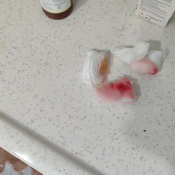 Bebek Mama Sandalyesi Kırıldı Çocuğum Hastanelik Oldu