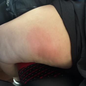 Metro Turizm'de Kırık Masa Ve Kaba Personel Mağduriyeti