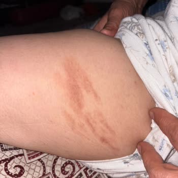 Metro Turizm'de Kırık Masa Ve Kaba Personel Mağduriyeti