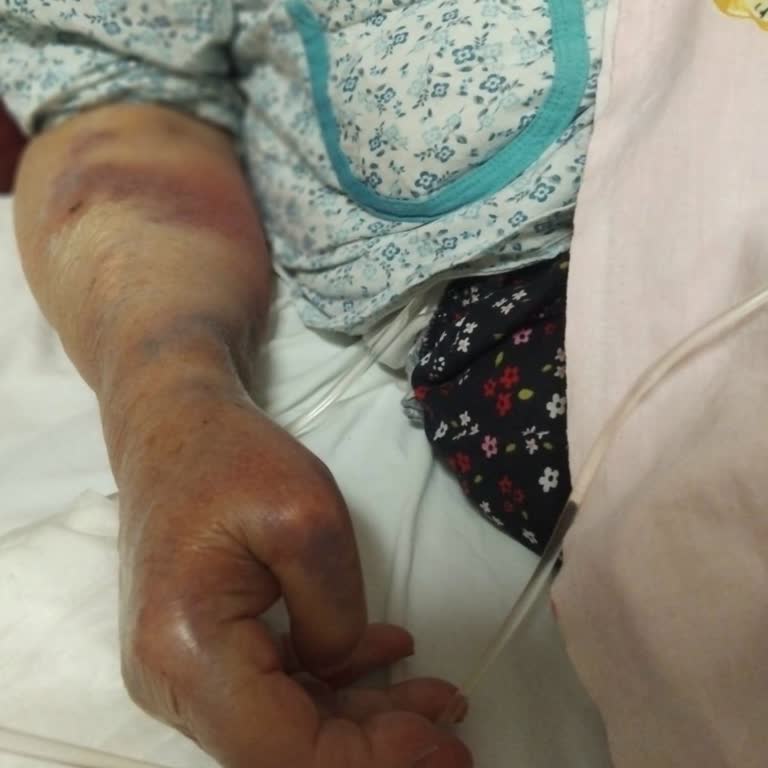 Pamukkale Üniversitesi Hastanesi'nde Yetersiz Bilgilendirme Ve Hasta Hakları İhlali