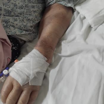 Pamukkale Üniversitesi Hastanesi'nde Yetersiz Bilgilendirme Ve Hasta Hakları İhlali